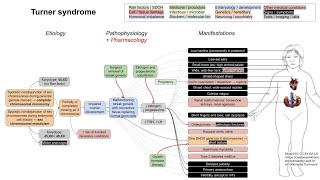 Turner syndrome mechanism of disease [upl. by Ramuk]