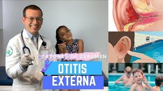 TAPON DE CERUMEN COMO CAUSA DE OTITIS EXTERNA [upl. by Kaila]