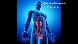 Cisti dellepididimo Video di Urologia e Andrologia  wwwurologiaandrologianet [upl. by Eenehs]