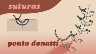 Suturas  PONTO DONATTI [upl. by Samala165]