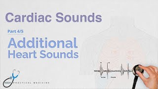 Additional Heart Sounds Pt 45 Cardiac Sounds Series [upl. by Mogerly964]