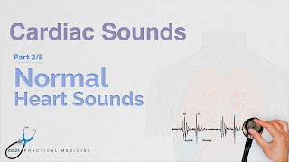 Normal Heart Sounds Pt 25 Cardiac Sounds Series [upl. by Ahsercal634]