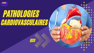 QCU en Pathologies Cardiovasculaires ‐ [upl. by Fia]