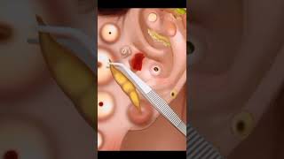 Asmr ear cleaning video  asmr ear cleaning video [upl. by Herodias]