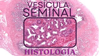 Histología de Vesícula seminal [upl. by Sears897]