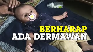 Ammar Idap Hidrosefalus sejak 6 Bulan di Kandungan Kini Dokter Sebut Ada Hernia [upl. by Idnahr]