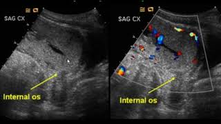 Ultrasound in the 2nd and 3rd Trimester [upl. by Anigal]