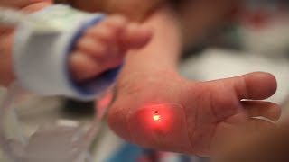 Sensors are first to monitor babies in the NICU [upl. by Trebron50]