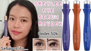 REVIEW EYE SERUM BREYLEE PEMAKAIAN 2 MINGGU RETINOL EYE SERUM [upl. by Leen999]