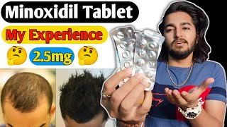 Minoxidil Tablet Experience  Lonitab 25mg Minoxidil Tablet [upl. by Jason]