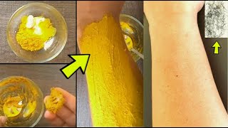 Remove Unwanted Hair Permanently at Home  DIY Unwanted Hair Removal for Women Naturally [upl. by Einapets]