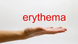 How to Pronounce erythema  American English [upl. by Adine]