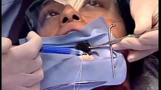 Chair Side Dental Assisting Training Video for Dental Staff [upl. by Yllut]