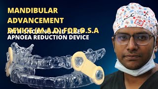 Dr Rudra Mohan  Mandibular Advancement Device for Obstructive Sleep Apnoea and Reduction in Snoring [upl. by Notluf504]