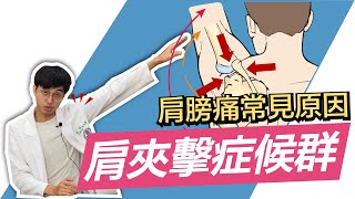 【常常肩膀痛嗎？肩膀痛最常見的肩夾擊症候群！】除了五十肩，你更應該知道的原因！｜MIDWAY米蔚健康教室 EP28 [upl. by Anayt]