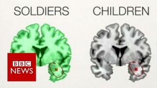 The PTSD brains of children amp soldiers  BBC News [upl. by Roselane]