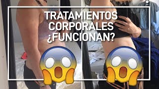 🆒 Criolipolisis cavitación y radiofrecuencia  Antes y Después ¿funciona [upl. by Eentroc761]