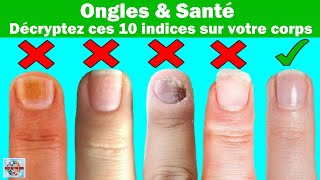 Ongles et santé  Décryptez ces 10 indices sur votre corps [upl. by Tait]