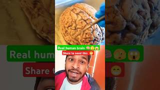 Real human brain 🧠😱 science humanbrain reaction viralvideo shortfeed trending [upl. by Penthea]