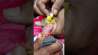 iv cannula kaise lagate hain intravenous cannulation shortsfeed [upl. by Lekcim751]