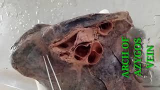 LUNGS PART2  ROOT AND RELATIONS  BY DR MITESH DAVE [upl. by Mellen]