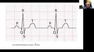 Basic interpretation of ECG strips The 5 step method [upl. by Ahker]