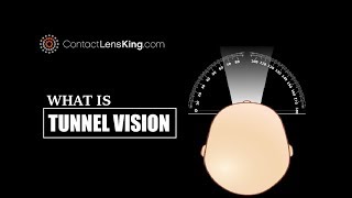 Whats Tunnel Vision Symptoms and Loss of Peripheral Vision [upl. by Suisyola454]