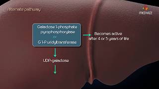 Metabolism of galactose Classic Galactosemia Galactokinase deficiency [upl. by Neddy]