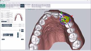 Direct printing of aligners  Deltaface orthodontic software [upl. by Doyle]