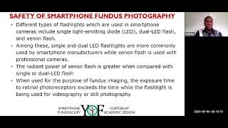 Smartphone Fundoscopy II [upl. by Auginahs]