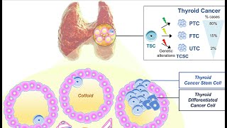 Non neoplastic diseases of the thyroid gland pathology quick recap by ASM Minds Team [upl. by Shae312]