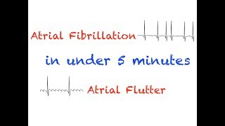 AFib and AFlutter Interpretation Under 5 minutes [upl. by Kostman]