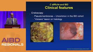 My Treatment Approach to Clostridioides difficile Infection [upl. by Drofnas]