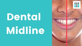 DENTAL MIDLINE SHIFT What why and how to correct l Dr Melissa Bailey [upl. by Anniala520]