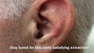 Ear cropping styles for Pitbulls [upl. by Arualana]