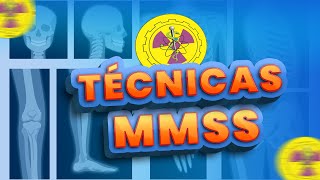 TODAS INCIDÊNCIAS DE ROTINA DOS MMSS  Radiologando [upl. by Aurel]