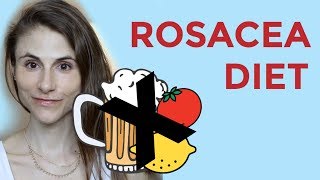 ROSACEA DIET FOODS SUPPLEMENTS PROBIOTICS DR DRAY [upl. by Drye]