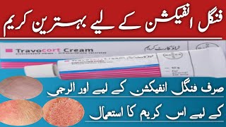 Travocort Cream benefit Uses in Urdu  hindi Best cream for fungal Infection [upl. by Asyle]