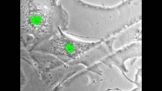 Regenerating heart cells [upl. by Mot154]