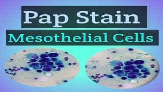 Pap Stain  Staining  Cytology  Mesothelial Cells  E Learn with Technologist [upl. by Kirk]