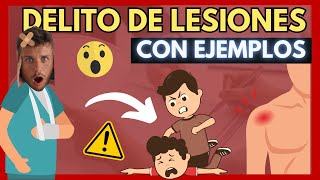 🔴 DELITO de LESIONES ¿Qué es ¿Tipos DESCUBRE TODO en MATERIA PENAL con EJEMPLOS [upl. by Jansen54]