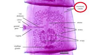 Diphyllobothrium Latum [upl. by Euqinot]