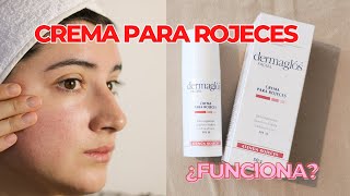 CREMA PARA ROJECES  Descongestiona suavza e hidrata  DERMAGLOS FACIAL con fps 30 [upl. by Benedicta]