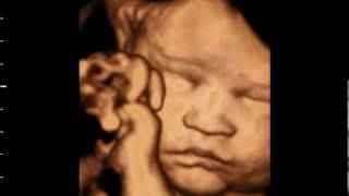 3D ultrasound at 31 weeks GoldenView Ultrasound [upl. by Moon]