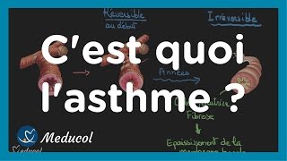 Lasthme cest quoi physiopathologie causes symptômes et traitement [upl. by Duester]