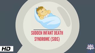 Sudden Infant Death syndrome Causes and Prevention [upl. by Stanislaus340]