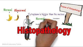 Histopathology  Tissue Processing  Tissue processing in histopathology laboratory [upl. by Ethbinium461]