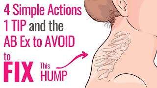 Dowagers Hump 4 SIMPLE Focused Actions 1 Tip to use all day amp the popular AB Exercise to AVOID [upl. by Waligore430]