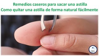 Remedios caseros para sacar una astilla  Como quitar una astilla de forma natural facilmente [upl. by Trillby797]