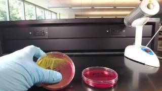 Mannitol Salt Agar [upl. by Adirahs]